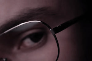 The Genetic Connection to Hair Loss What You Need to Know